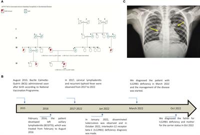 Autosomal recessive IL12RB1 mutation: A case report of a Sudanese child and his father